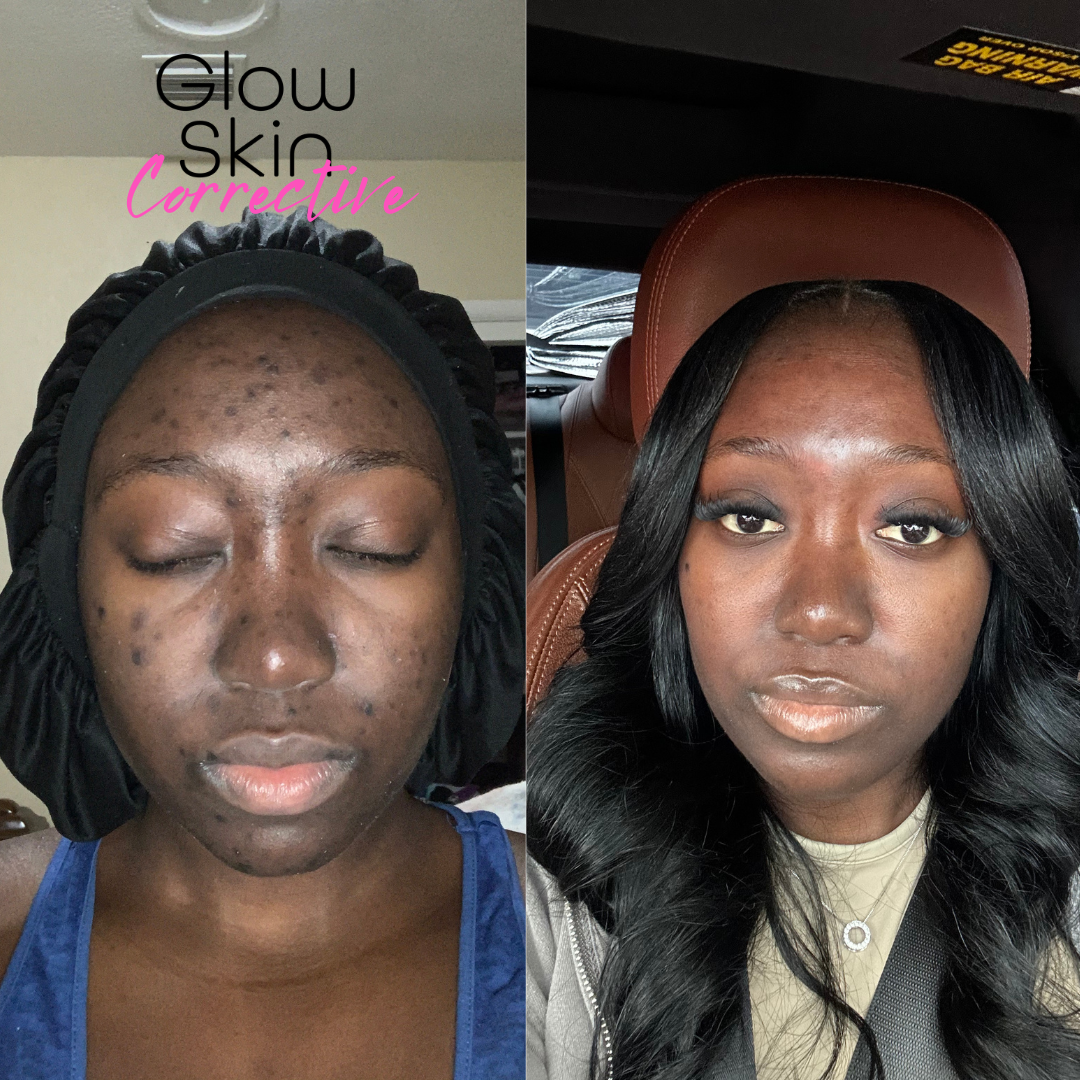 Corrective Glow Kit