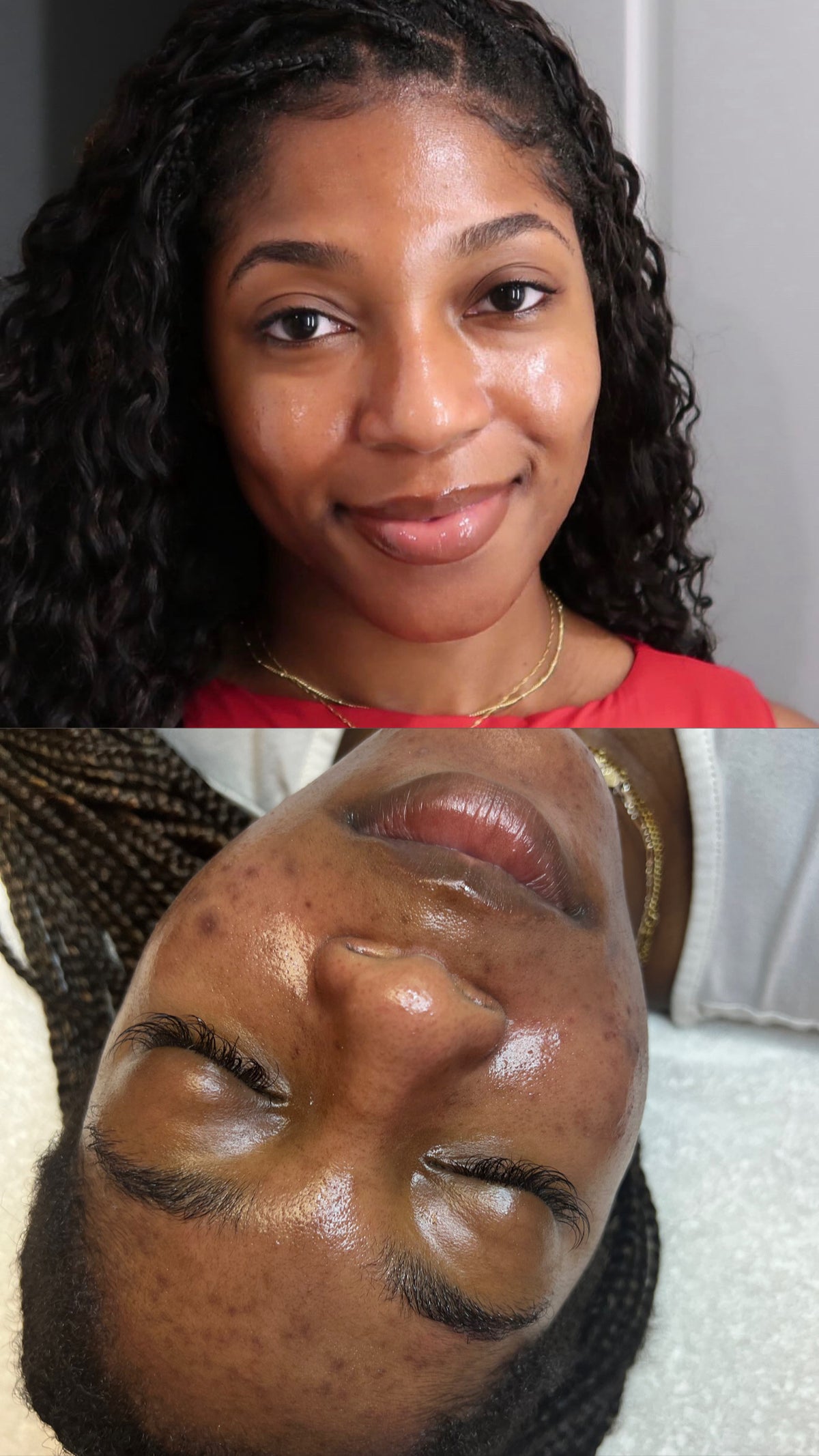 Corrective Glow Kit