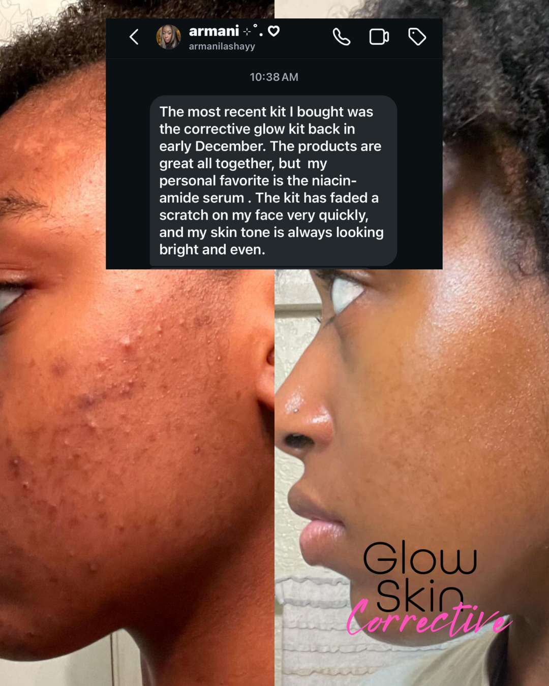 Corrective Glow Kit