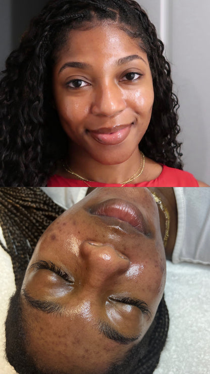 Corrective Glow Kit