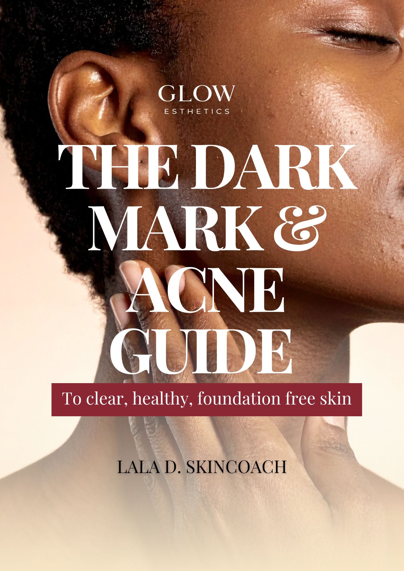 The Dark Mark &amp; Acne Guide